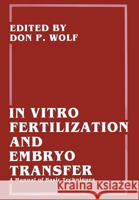 In Vitro Fertilization and Embryo Transfer: A Manual of Basic Techniques Bavister, Barry D. 9781461282884
