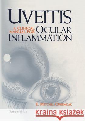 Uveitis: A Clinical Manual for Ocular Inflammation Kachelein, K. 9781461286851 Springer