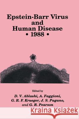 Epstein-Barr Virus and Human Disease - 1988 Ablashi, D. V. 9781461288527 Humana Press
