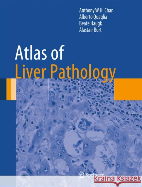 Atlas of Liver Pathology Anthony W. H. Chan Alberto Quaglia Beate Haugk 9781461491132