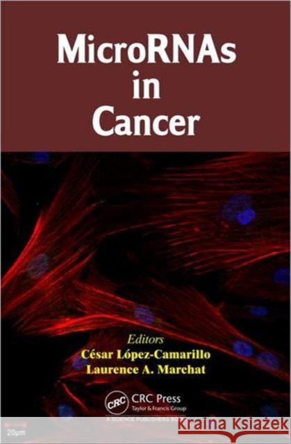 Micrornas in Cancer Lopez-Camarillo, Cesar 9781466576766 CRC Press