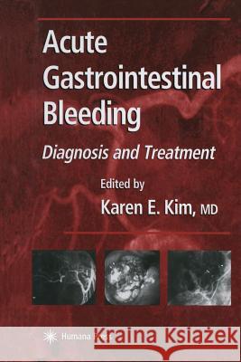 Acute Gastrointestinal Bleeding: Diagnosis and Treatment Kim, Karen E. 9781468497236 Humana Press