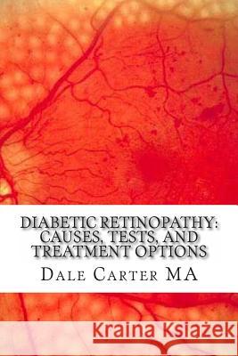 Diabetic Retinopathy: Causes, Tests, and Treatment Options Dale Carter Ma Edward Montgomery 9781477447628