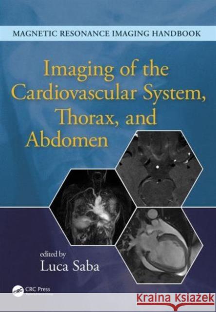 Imaging of the Cardiovascular System, Thorax, and Abdomen Luca Saba   9781482216264