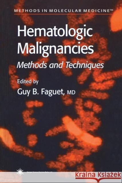 Hematologic Malignancies: Methods and Techniques Faguet, Guy B. 9781489942166 Humana Press