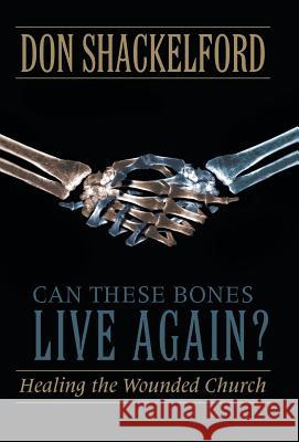 Can These Bones Live Again?: Healing the Wounded Church Shackelford, Don 9781490816326