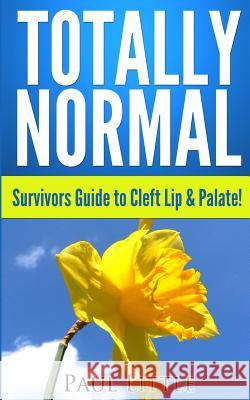 Totally Normal: Survivors Guide to Cleft Lip & Palate! Dr Paul B. Little 9781492306368 Createspace