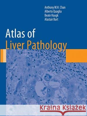 Atlas of Liver Pathology Wing Hung Anthony Chan Alberto Quaglia Beate Haugk 9781493943531