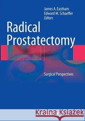 Radical Prostatectomy: Surgical Perspectives Eastham, James A. 9781493946570 Springer
