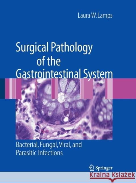 Surgical Pathology of the Gastrointestinal System: Bacterial, Fungal, Viral, and Parasitic Infections Lamps, Laura W. 9781493951451