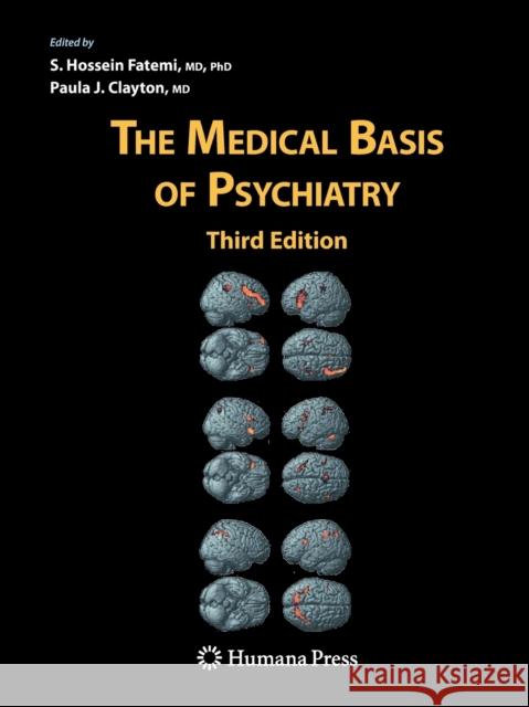 The Medical Basis of Psychiatry S. Hossein Fatemi Norman Sartorius Paula J. Clayton 9781493960880