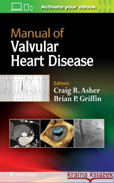 Manual of Valvular Heart Disease Craig R. Asher Brian P. Griffin 9781496310125