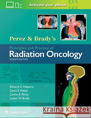 Perez & Brady's Principles and Practice of Radiation Oncology Edward C. Halperin David E. Wazer Carlos A. Perez 9781496386793