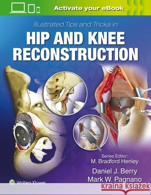 Illustrated Tips and Tricks in Hip and Knee Reconstructive and Replacement Surgery Daniel J. Berry Mark W. Pagnano 9781496392060
