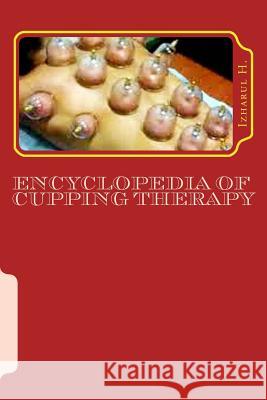 Encyclopedia of Cupping Therapy: Al-Hijama Izharul H 9781508981503 Createspace