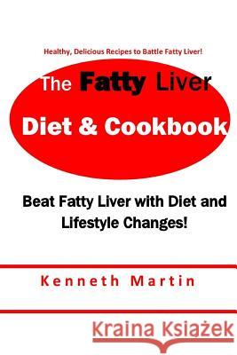 The Fatty Liver Diet & Cookbook: Beat Fatty Liver with Diet & Lifestyle Changes Kenneth Martin 9781540830302