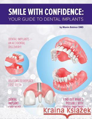 Smile with confidence: Your guide to dental implants Babiner DMD, Maxim 9781542718103 Createspace Independent Publishing Platform