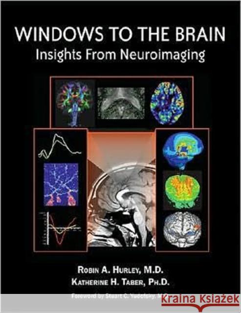 Windows to the Brain: Insights from Neuroimaging Hurley, Robin A. 9781585623020 American Psychiatric Publishing, Inc.