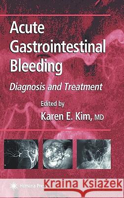 Acute Gastrointestinal Bleeding: Diagnosis and Treatment Kim, Karen E. 9781588290045 Humana Press