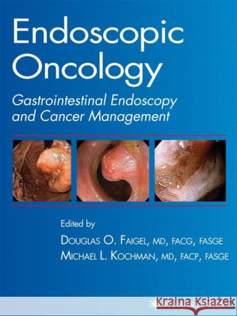 Endoscopic Oncology Douglas O. Faigel Michael L. Kochman 9781588295323 Humana Press