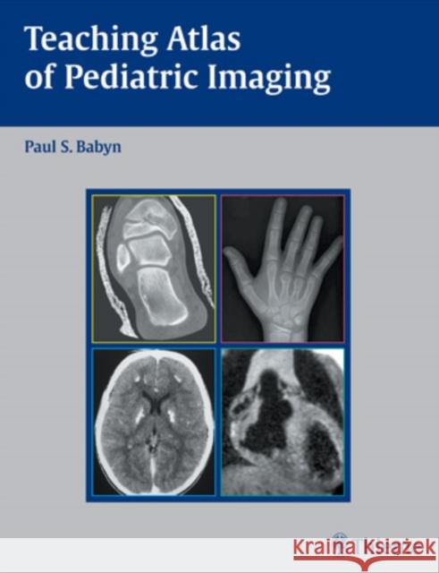 Teaching Atlas of Pediatric Imaging Paul S. Babyn 9781588903396 Thieme Medical Publishers