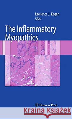 The Inflammatory Myopathies Lawrence Kagen 9781603278287 Humana Press