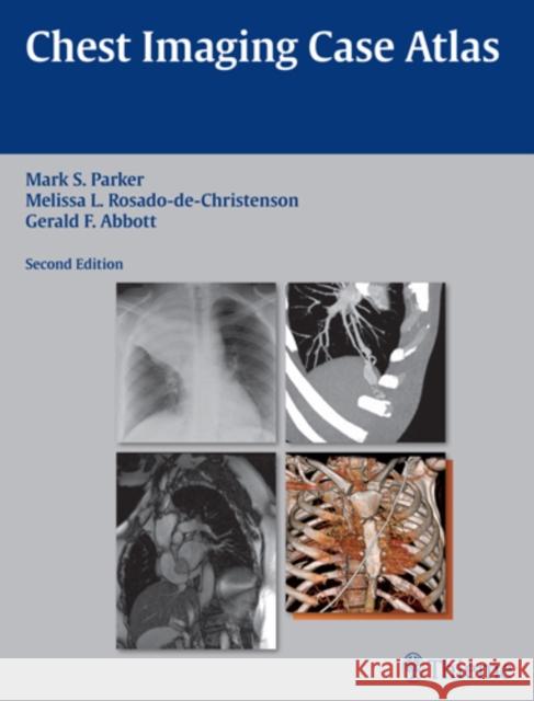 Chest Imaging Case Atlas Mark Parker Melissa D Gerald Abbott 9781604065909