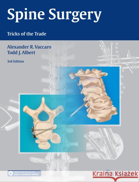 Spine Surgery: Tricks of the Trade Vaccaro, Alexander R. 9781604068962 Thieme Medical Publishers