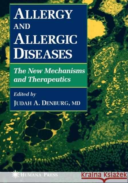 Allergy and Allergic Diseases: The New Mechanisms and Therapeutics Denburg, Judah A. 9781617370267 Springer