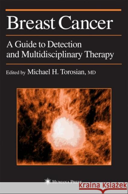 Breast Cancer: A Guide to Detection and Multidisciplinary Therapy Torosian, Michael H. 9781617372162 Springer