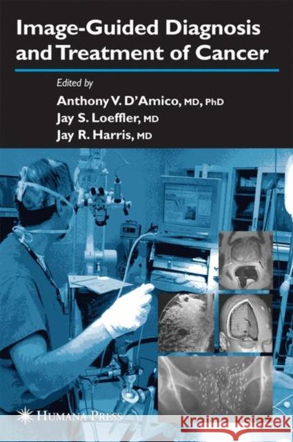 Image-Guided Diagnosis and Treatment of Cancer Anthony V. D'Amico Jay R. Harris 9781617373688 Springer