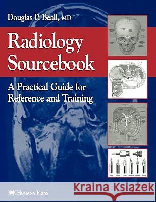 Radiology Sourcebook: A Practical Guide for Reference and Training Beall, Douglas P. 9781617373770 Springer