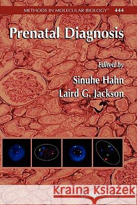 Prenatal Diagnosis Sinuhe Hahn Laird G. Jackson 9781617377877 Springer