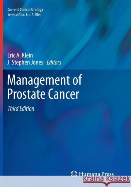 Management of Prostate Cancer Eric A. Klein J. Stephen Jones 9781617797392 Humana Press