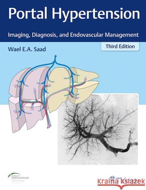 Portal Hypertension: Imaging, Diagnosis, and Endovascular Management Saad, Wael E. a. 9781626233270 Thieme Medical Publishers