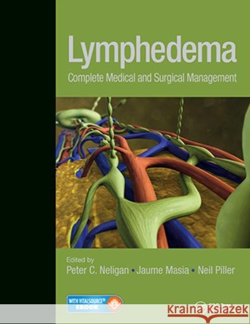 Lymphedema : Complete Medical and Surgical Management. With E-Book Peter Neligan, MD Jaume Masia Neil Piller 9781626236714