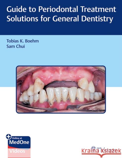 Guide to Periodontal Treatment Solutions for General Dentistry Boehm, Tobias K. 9781626238008 Thieme Medical Publishers