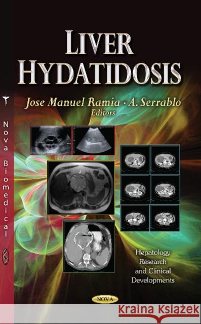 Liver Hydatidosis Jose Manuel Ramia, A Serrablo 9781628084597 Nova Science Publishers Inc