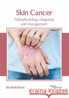 Skin Cancer: Pathophysiology, Diagnosis and Management Elizabeth Burns 9781632416957 Hayle Medical