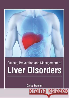 Causes, Prevention and Management of Liver Disorders Daisy Truman 9781632426840 Foster Academics