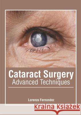 Cataract Surgery: Advanced Techniques Lorenzo Fernandez 9781632427540 Foster Academics