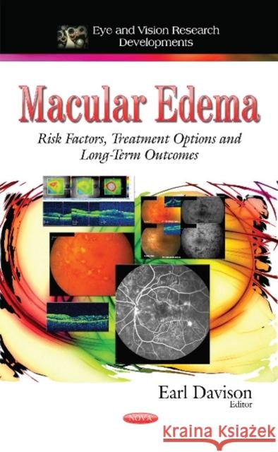 Macular Edema: Risk Factors, Treatment Options and Long-Term Outcomes Earl Davison 9781633215849 Nova Science Publishers Inc