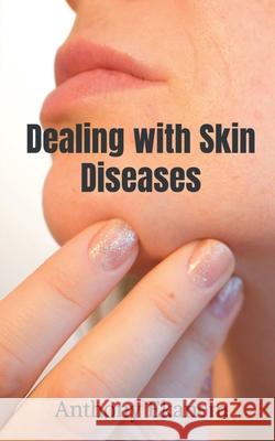 Dealing with Skin Diseases Anthony Ekanem 9781639977352