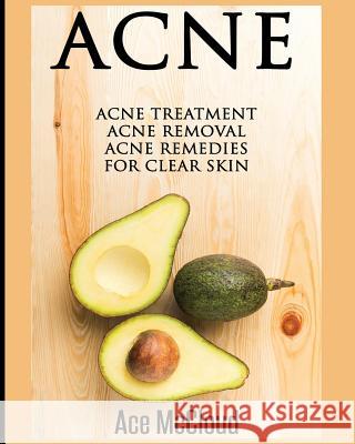 Acne: Acne Treatment: Acne Removal: Acne Remedies For Clear Skin Ace McCloud 9781640481268 Pro Mastery Publishing
