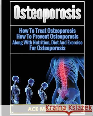Osteoporosis: How To Treat Osteoporosis: How To Prevent Osteoporosis: Along With Nutrition, Diet And Exercise For Osteoporosis Ace McCloud 9781640481848