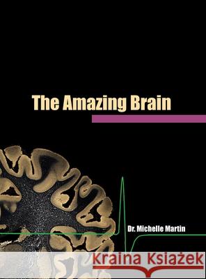The Amazing Brain Michelle Martin, Carmen Still 9781678164614