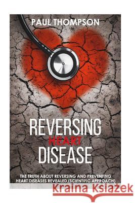 Reversing heart disease: The truth about reversing and preventing heart diseases revealed(scientific approach) Thompson, Paul 9781718962163