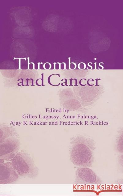 Thrombosis and Cancer Anna Gille Gilles Lugassy Anna Falanga 9781841842875 Taylor & Francis Group