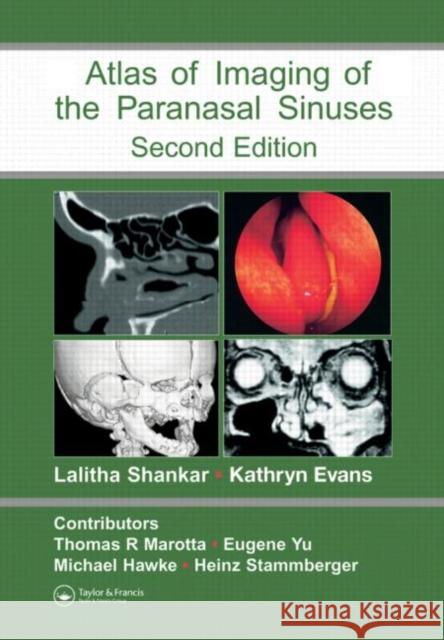 An Atlas of Imaging of the Paranasal Sinuses Shankar, Lalitha 9781841844480 Informa Healthcare