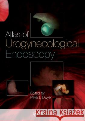 Atlas of Urogynecological Endoscopy Peter L. Dwyer Dwyer L. Dwyer 9781841845401